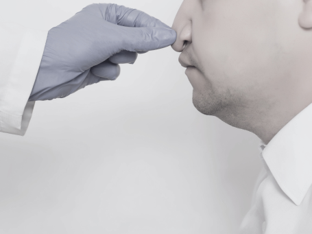 Fotografía de una cirugía endoscópica nasal realizada por el Dr. Javier García Gómez en Cáceres. Procedimientos mínimamente invasivos 
